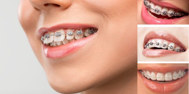 upload/ortodonti-tedavisi-nedir-.jpg